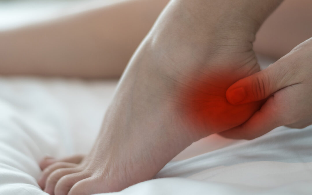 Can CBD Help Relieve Your Plantar Fasciitis?